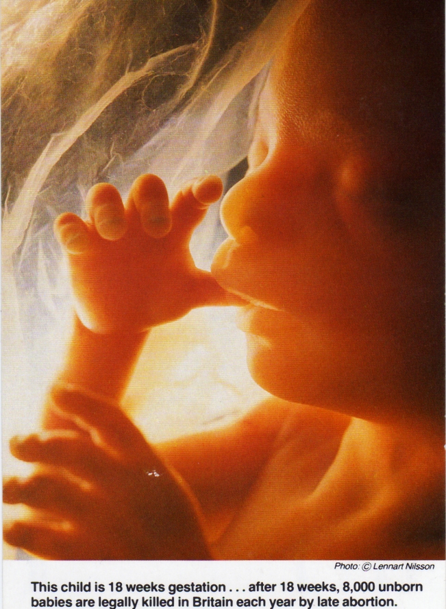 1987-the-photographer-lenart-neilson-gave-permission-for-this-picture-of-the-unborn-baby-at-18-weeks-to-be-used-for-the-alton-bill-campaign-1-million-were-printed-1.jpg